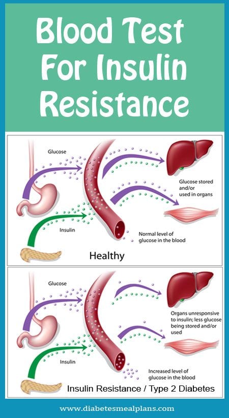 Insulin Resistance Levels Chart