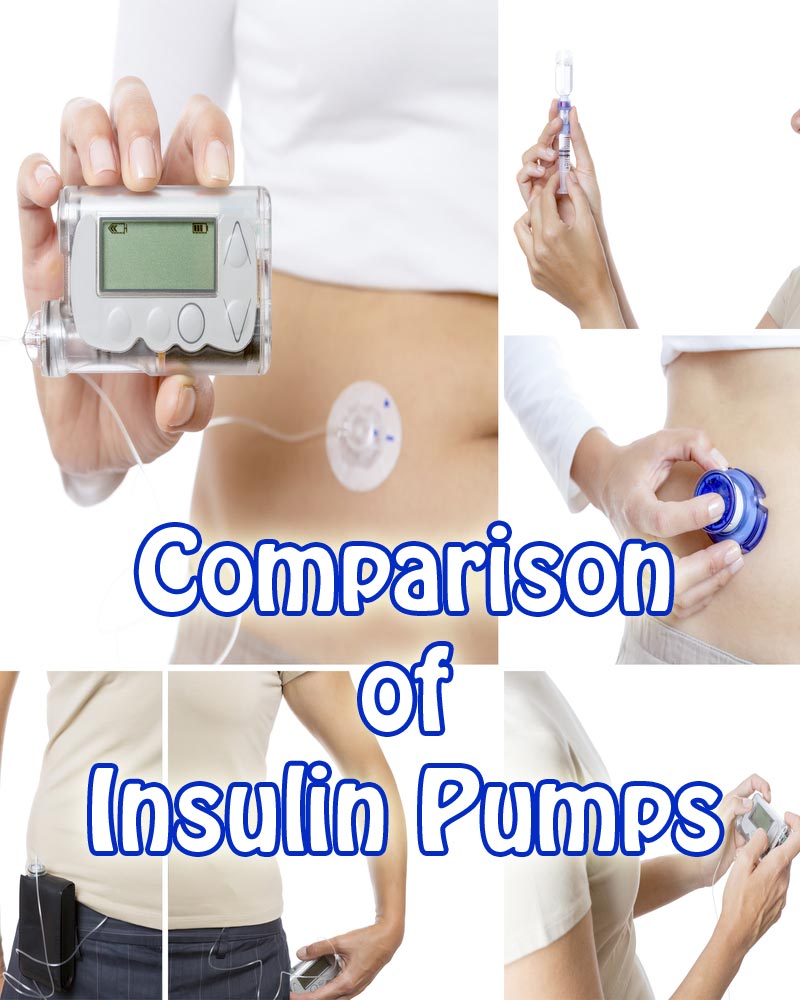 Insulin pump prices comparison