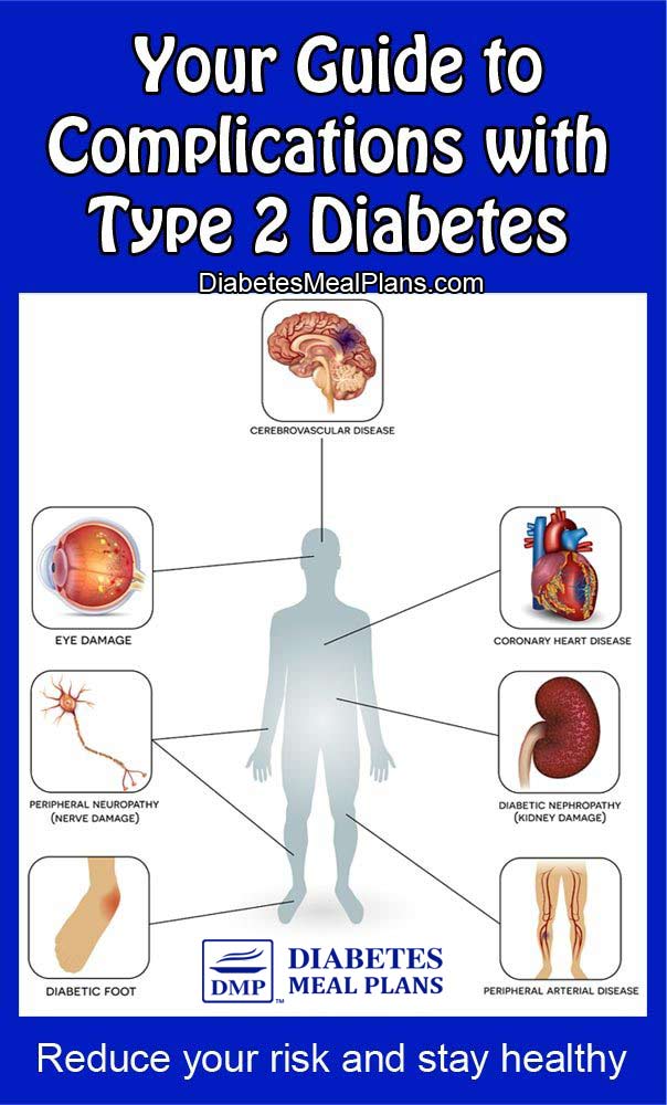 Type 2 Diabetes Complications Causes And Prevention - Vrogue.co