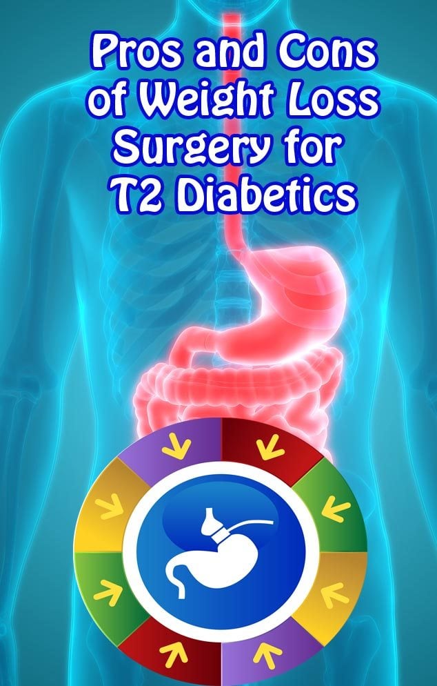 Weight loss surgery for diabetes