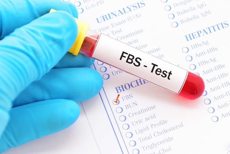 How Long Fasting For Blood Sugar Test